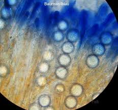 Attēlu rezultāti vaicājumam “Lamprospora tortulae-ruralis”