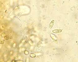 Attēlu rezultāti vaicājumam “Rhizopogon luteolus”