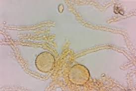 Attēlu rezultāti vaicājumam “Perichaena depressa”