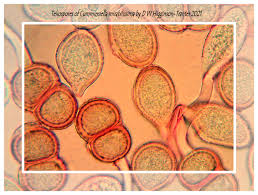 Attēlu rezultāti vaicājumam “Milesina murariae”