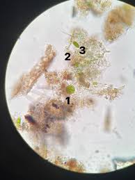Attēlu rezultāti vaicājumam “Gloeocapsa rupestris”