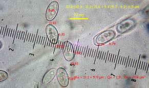 Attēlu rezultāti vaicājumam “Fuligo leviderma macro”