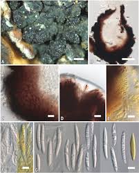 Attēlu rezultāti vaicājumam “Licea minima spores”