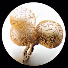 Attēlu rezultāti vaicājumam “Cribraria ferruginea spores”