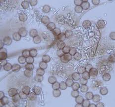 Attēlu rezultāti vaicājumam “Didymium clavus”