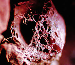 Attēlu rezultāti vaicājumam “Cribraria rubiginosa spores”