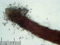 Attēlu rezultāti vaicājumam “Melanospora lagenaria”