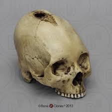 Image result for elongated skulls