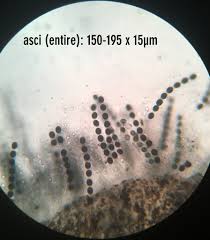 Attēlu rezultāti vaicājumam “Biscogniauxia marginata”