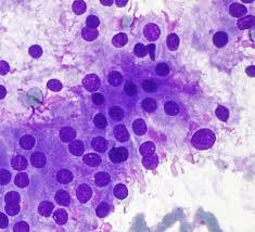 Image result for Graves Flames