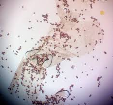 Attēlu rezultāti vaicājumam “Lamproderma arcyrioides spores”