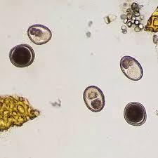 Image result for cestoda excrement dog