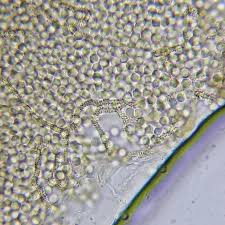 Attēlu rezultāti vaicājumam “Arcyria affinis spores”