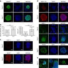 Attēlu rezultāti vaicājumam “Siphoptychium violaceum plasmodium”