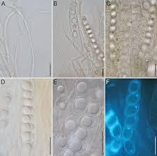 Attēlu rezultāti vaicājumam “Octosporella jungermanniarum”