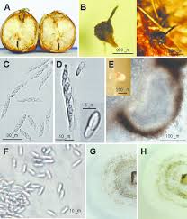 Attēlu rezultāti vaicājumam “Licea castanea spores”
