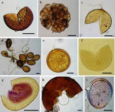 Attēlu rezultāti vaicājumam “Stemonitopsis aequalis var. microspora spores”