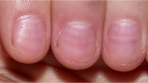 Image result for lunula nail