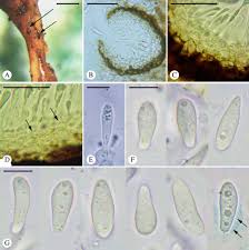 Attēlu rezultāti vaicājumam “Athelia pyriformis”