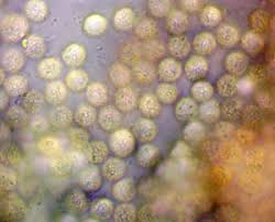 Attēlu rezultāti vaicājumam “Lycogala sphaeroconicum macro”