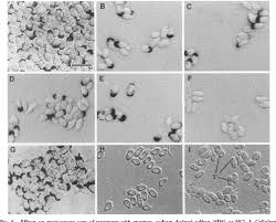Attēlu rezultāti vaicājumam “Tranzschelia pruni-spinosae spores”