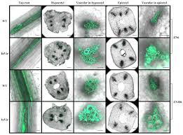 Attēlu rezultāti vaicājumam “Didymium verrucisporum spores”
