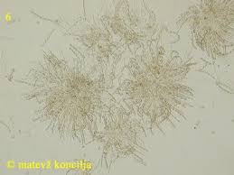 Attēlu rezultāti vaicājumam “Neonectria fuckeliana”