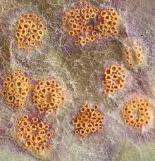 Attēlu rezultāti vaicājumam “Puccinia poarum”
