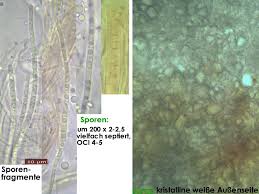 Attēlu rezultāti vaicājumam “Stictis”