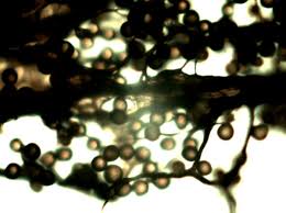 Attēlu rezultāti vaicājumam “Amaurochaete atra macro”