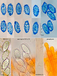 Attēlu rezultāti vaicājumam “Melastiza chateri”