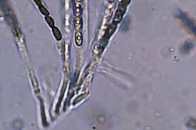 Attēlu rezultāti vaicājumam “Hypoxylon fuscum”