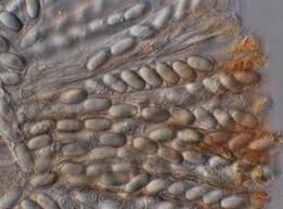 Attēlu rezultāti vaicājumam “Cheilymenia stercorea”