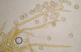 Attēlu rezultāti vaicājumam “Trichia varia”