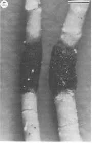 Attēlu rezultāti vaicājumam “Biatoropsis usnearum”