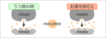 Image result for うつ病 亜型分類