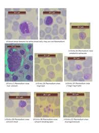 Attēlu rezultāti vaicājumam “Reticularia lobata plasmodium”