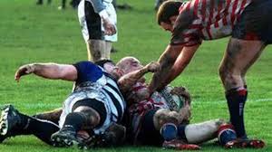 Image result for Kirkby Lonsdale Rugby Football Club