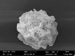 Attēlu rezultāti vaicājumam “Fossombronia wondraczekii spores”