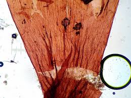 Attēlu rezultāti vaicājumam “Trichia erecta”