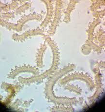 Attēlu rezultāti vaicājumam “Trichiaceae, Hemitrichiaceae, Arcyriaceae”