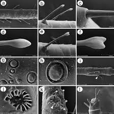 Attēlu rezultāti vaicājumam “Macrosiphoniella absinthii”