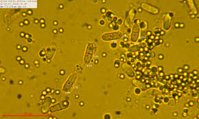 Attēlu rezultāti vaicājumam “Nectriopsis violacea”