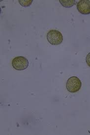 Attēlu rezultāti vaicājumam “Hemitrichia lutescens spores”