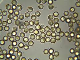 Attēlu rezultāti vaicājumam “Cribraria aurantiaca spores”