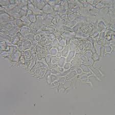 Attēlu rezultāti vaicājumam “Athelia arachnoidea”