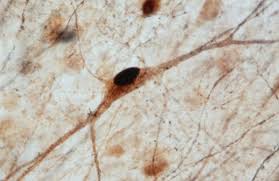 Attēlu rezultāti vaicājumam “Physarum obscurum sessile”