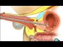 Cystoscopy