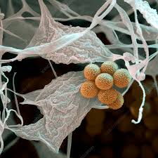 Attēlu rezultāti vaicājumam “Badhamia versicolor spores”