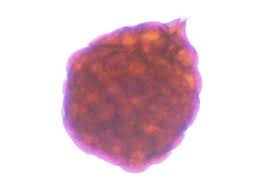 Attēlu rezultāti vaicājumam “Bryum rubens”